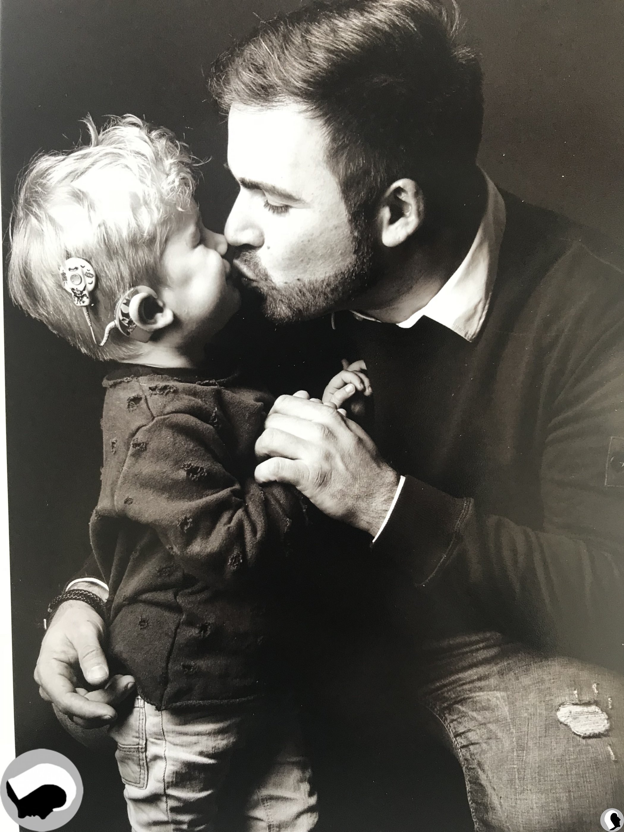 CI Kopf 2018 männlich Kind